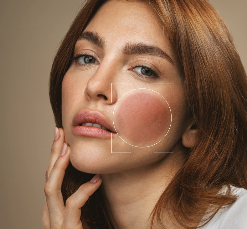 Palmea eco bio cosmesi test cutaneo